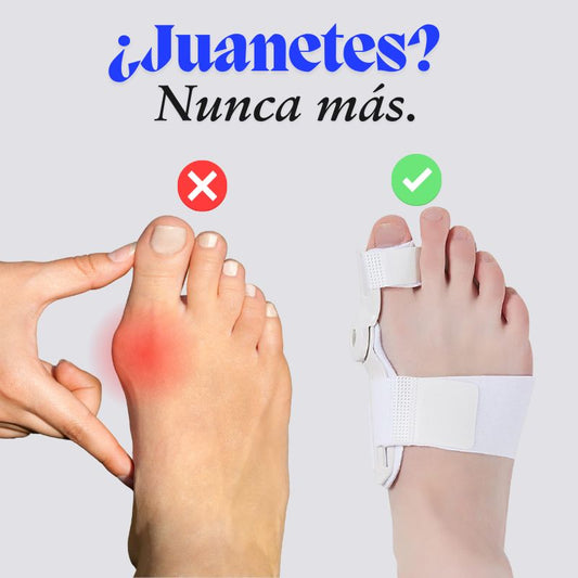 Corrector de Juanete Ortopé